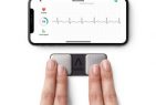 AliveCor, global leader in personal electrocardiogram (ECG) technology announces KardiaMobile to monitor and alert people experiencing irregular heart rhythm symptoms, 24 hours in advance